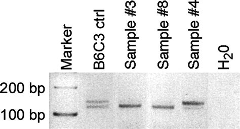 —loss Of Heterozygosity Analysis Of P53 Gene In Brain Tumors From Download Scientific Diagram