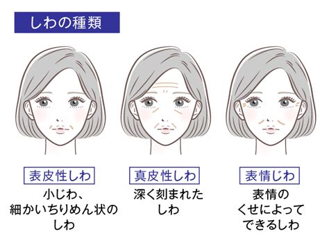 しわ対策のポイント｜肌のハリを取り戻すために意識したいスキンケア メディプラス乾燥予防研究所