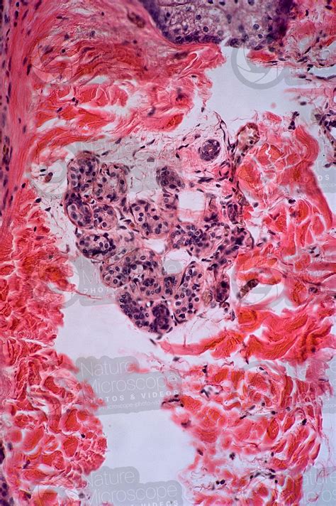 Man Sweat Gland Vertical Section X Sweat Gland Mammals