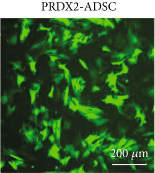 Characterization Of ADSCs And PRDX2 ADSCs A B Morphology Of ADSCs