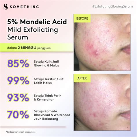 Buy Somethinc Combo Exfoliating Glowing Sensitive Skin Original Best