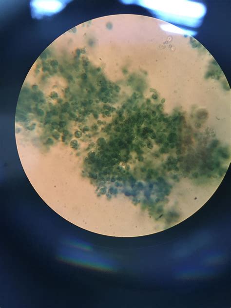Section 20 1 The Kingdom Protista Answer Key