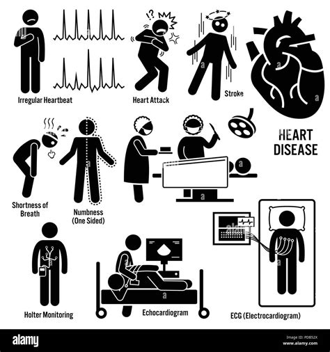 Enfermedades cardíacas Imágenes de stock en blanco y negro - Alamy