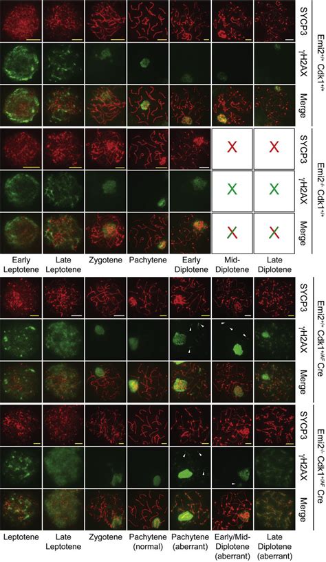 Elevated Cdk1 Activity Results in Persistence of Double-Strand Breaks ... 