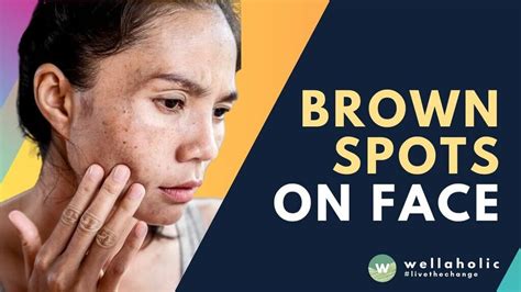 The Secret To Removing Brown Spots A Singaporeans Guide