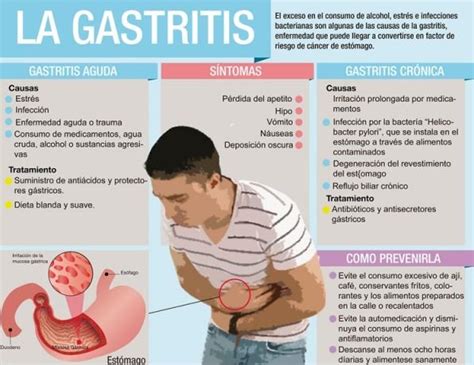 Enfermedades Mas Comunes Del Aparato Digestivo Parte I