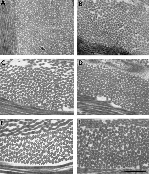 Transmission Electron Micrographs Containing Cross Sections Of Collagen