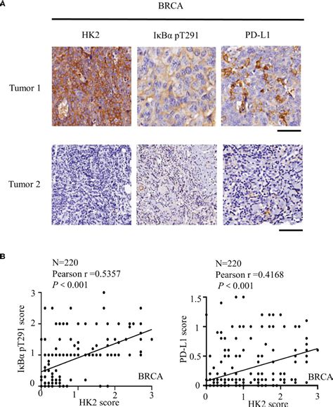 Frontiers Glycolytic Enzyme Hk2 Promotes Pd L1 Expression And Breast Cancer Cell Immune Evasion