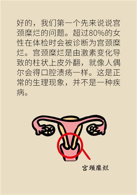 警惕女性常见病，医生告诉你何时该做妇科检查女性疾病频道东方养生