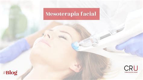 ¿qué Es La Mesoterapia Facial Clinica Rollon Ugalde