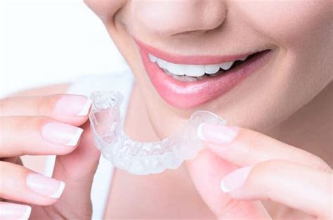 Invisible Braces in Borivali West - Roosh Dental Clinic