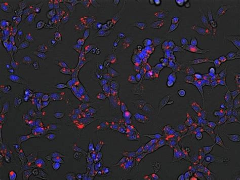 Invitrogen Low Density Lipoprotein From Human Plasma Phrodo Green