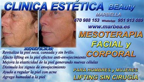 Mesoterapia Marbella Tratamiento Facial Corporal Rejuvenecimiento