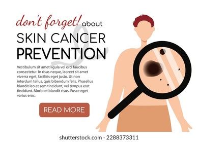 Melanoma Skin Cancer Prevention Concept Man Stock Vector (Royalty Free ...