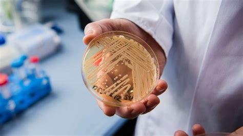 Potentially deadly fungus spreading rapidly in US health care ...