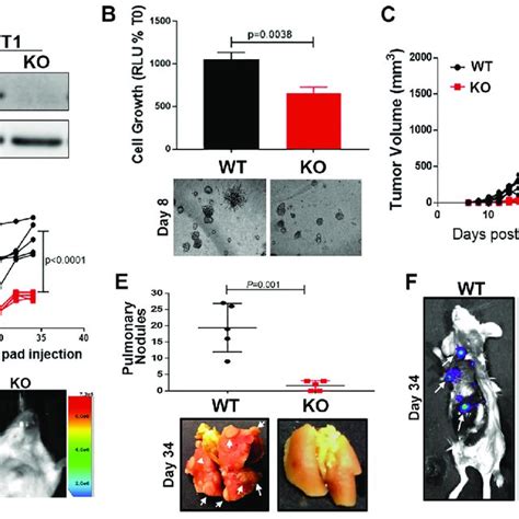 Transglutaminase 2 Promotes EV Mediated Pulmonary Niche Formation A