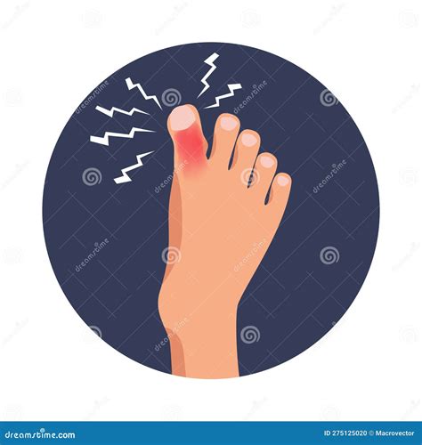 Toe Injury Icon stock vector. Illustration of concept - 275125020