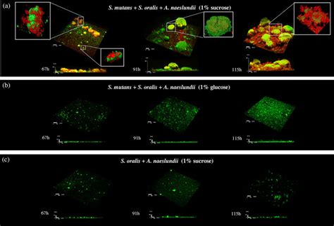 Representative Three Dimensional Images Of Multispecies Biofilms Grown