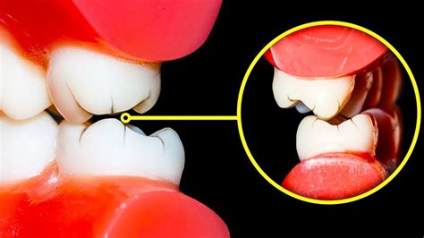 Como parar de Ranger os Dentes à Noite e por que É Perigoso YouTube