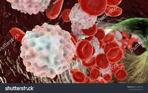 Lymphocytosis Leukocytosis 3d Illustration Showing Abundant Stock