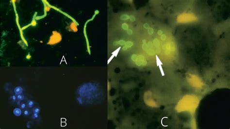 Calcofluor White Staining Principle Procedure Results Applications Biology Notes Online