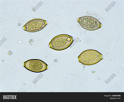 Egg Of Trichuris Trichiura In Stool Analyze By Microscope Stock Photo