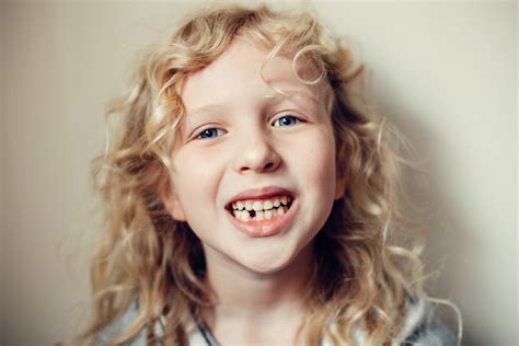 7 Types of Bite Teeth | How to Fix Them?