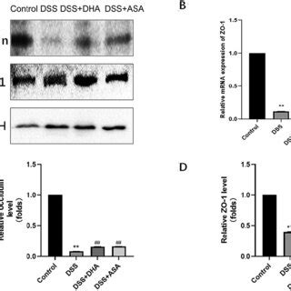 Effect Of DHA On Tight Junction Proteins In Mice Colon Tissue In