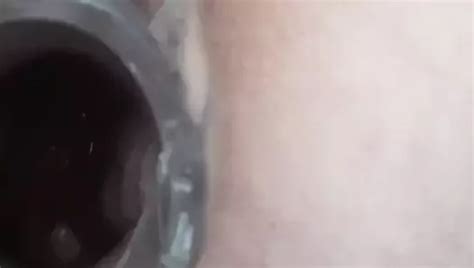 Speculum Gape Deep Inside My Ass Nude Pics XHamster