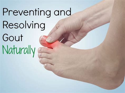 Treating the pain and causes of gout naturally – Artofit