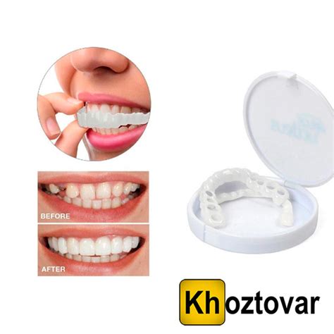 Съемные виниры на зубы Snap On Smile - купить по выгодной цене ...