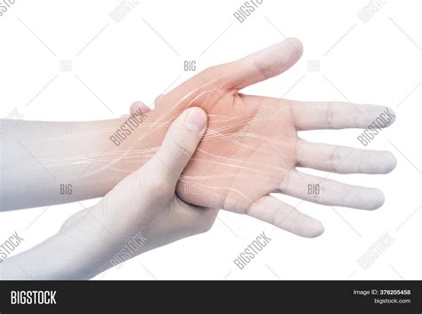 Hand Nerve Pain White Image & Photo (Free Trial) | Bigstock