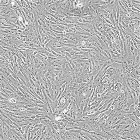 Sh Sy5y细胞人神经母细胞瘤人源细胞系现货细胞类丰晖生物【官网】细胞购买稳转株原代细胞病毒包装质粒购买载体构建