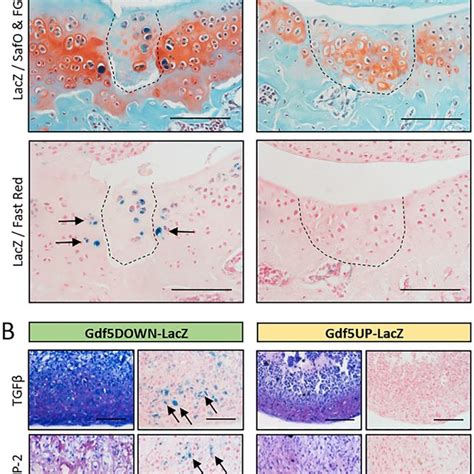 Gdf5 Expression In Articular Cartilage Following Dmm A Lacz