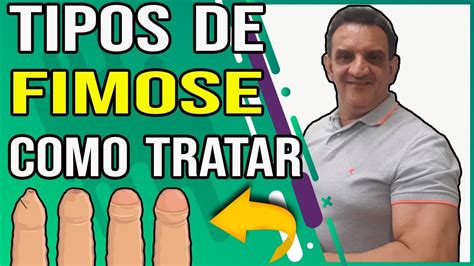 Fimosegrau Da Fimose Como Tratar A Fimose Em Casa Youtube