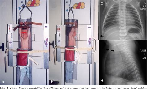 PDF Radiation Protection In Pediatric Radiography Introducing Some