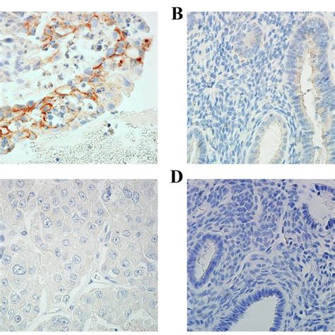 Immunostaining For Gpr In Ecs And Ne A Cytoplasmic Reaction Of