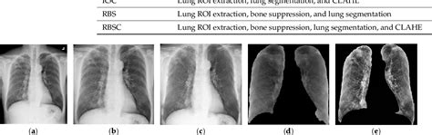 Figure 3 From Deep Learning Based Classification And Semantic