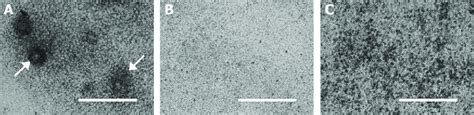 Formation Of Mineralizing Cartilage Nodules In Atdc Cells