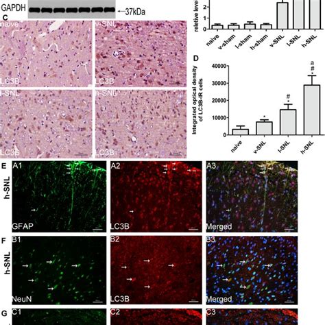 Saha Treatment Induces A Change In P Modulation In Neuropathic Pain