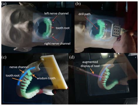 Applied Sciences Free Full Text Augmented Reality In Surgical