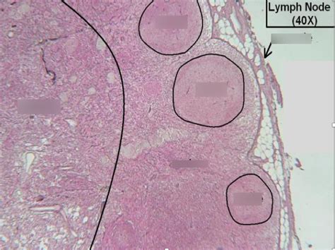 Lymph Node Microscope Slide Exam Diagram Quizlet