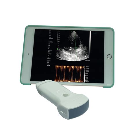 Wireless Android Ultrasound Probe Wifi Usb Ultrasound Convex Linear