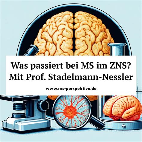 Was Passiert Bei Ms Im Zns Mit Prof Stadelmann Nessler