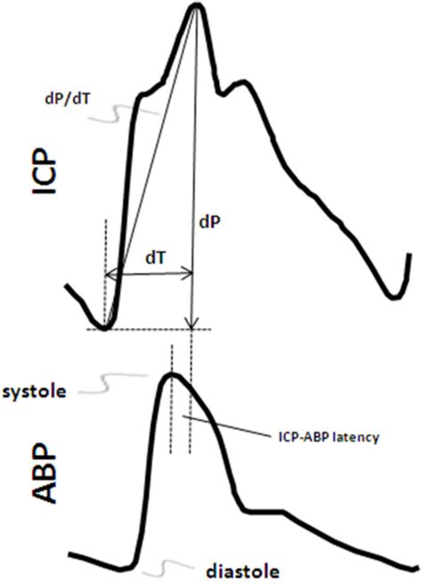 Timing Aspects Of The Intracranial And Arterial Pressure Waveforms