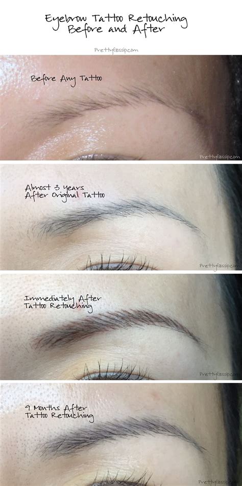 tattoo removal for eyebrows 2