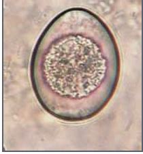 Coccidia Flashcards Quizlet