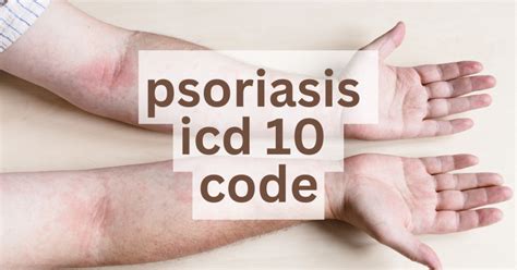 Psoriasis ICD 10 Codes Explained Including Inverse 54 OFF