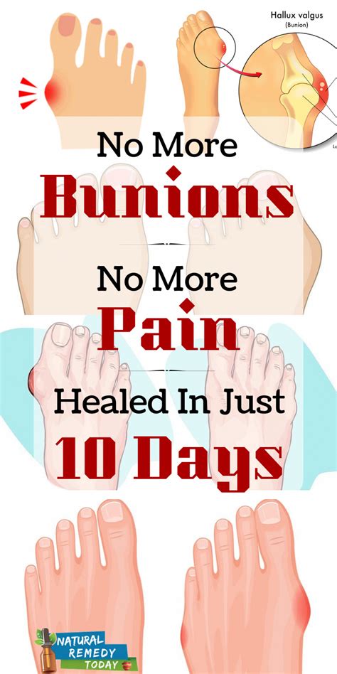 How To Clean A Glass Cooktop Get Rid Of Bunions Bunion Remedies