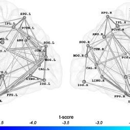 Regions With Significant Differences In Nodal Efficiency Between Ad